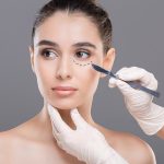 naluda-woman-facelift-lines