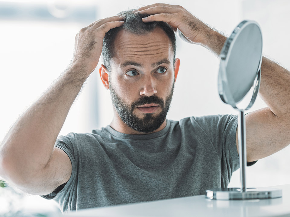 man with hair loss problem